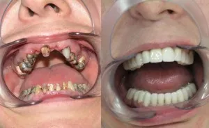 Какво по-добри зъби Паста