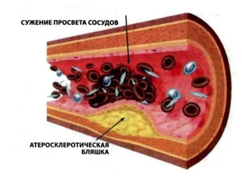 Cum afecteaza fumatul tensiunii arteriale și a vaselor de sânge ale organismului