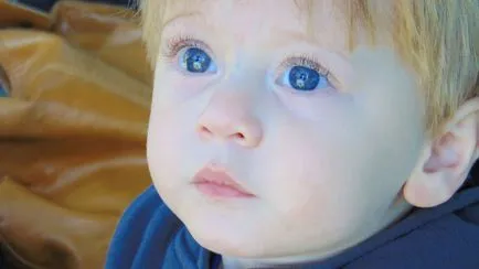 Hogyan lehet azonosítani és kezelni a tompalátás ( „lusta” szemet) a gyermek