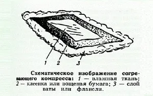 Компресиране на гърлото на водка, как да се направи компрес на гърлото водка и алкохол в дома си