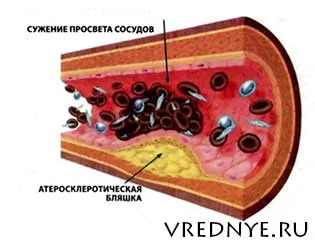 A dohányzás szűkíti vagy tágítja az ereket - egy nehéz kérdés