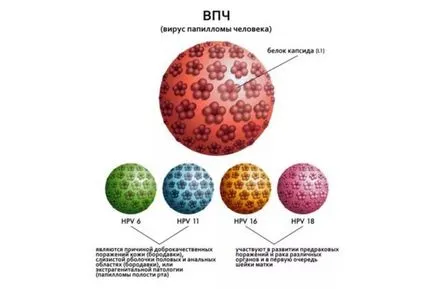 Tratamentul și prevenirea verucilor subcutanate