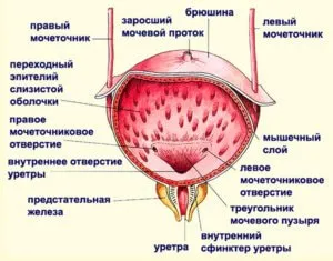 цистит лечение народни средства, различни методи