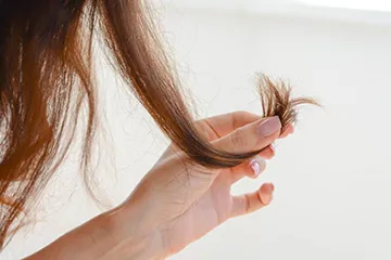 Лечение на косата пожар - плюсове и минуси