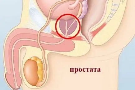 Tratamentul variațiilor noroi prostatita Saki și reguli de procedură