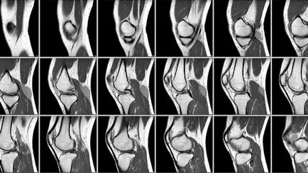 MRI снимки на мозъка, гръбначния стълб, коленна става - моят живот