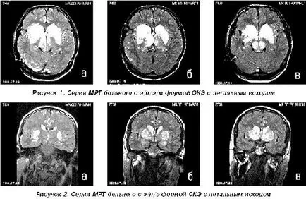 MRI снимки на мозъка, гръбначния стълб, коленна става - моят живот