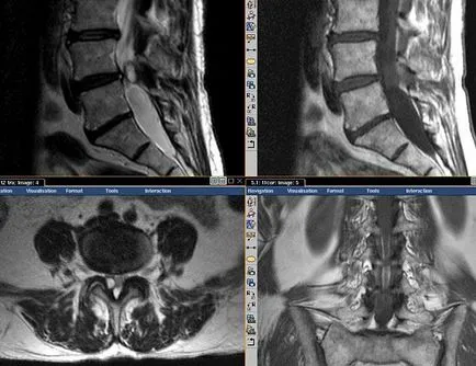 MRI снимки на мозъка, гръбначния стълб, коленна става - моят живот