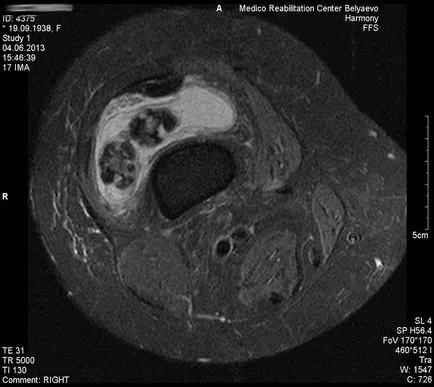 MRI на колянната става и коляното Dikulja Център