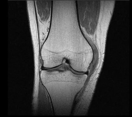 MRI на колянната става и коляното Dikulja Център