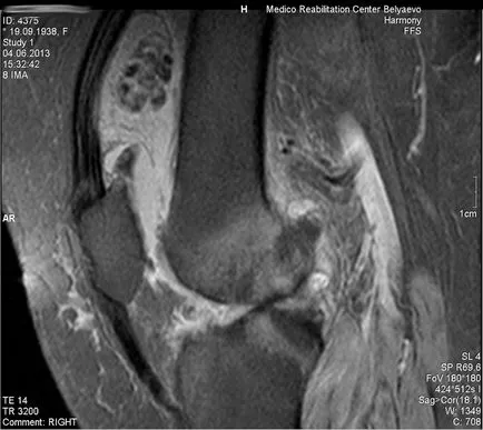 MRI на колянната става и коляното Dikulja Център