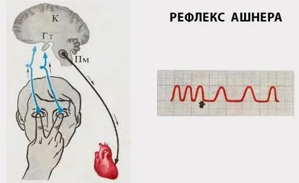 asistenta de urgenta pentru fibrilatie atriala in casa