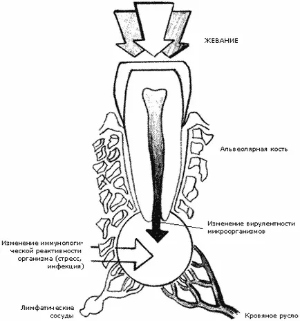 Tratamentul non-chirurgical al granulom radiculare și kistogranulem