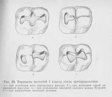 Tehnica operatorie de preparare a cariilor dentare carie, stomatologie preventivă