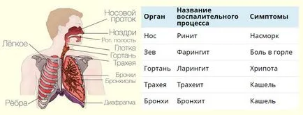 След синузит не отива хрема и запушване на носа