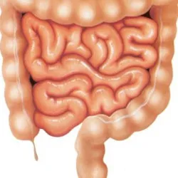 Proctosigmoiditis - a besorolás a betegség, a tünetek és a kezelés jellemzői