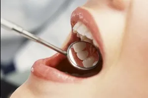 Megelőzés a fogászatban