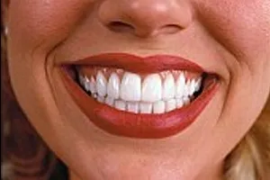 Превенция в стоматологията