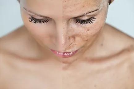 A propolisz a bőr, az arc és a nyálkahártya felületek