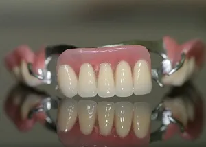 Протеза при липсата на голям брой на зъбите