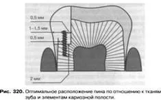 устройство за задържане