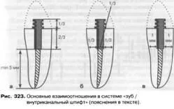 устройство за задържане