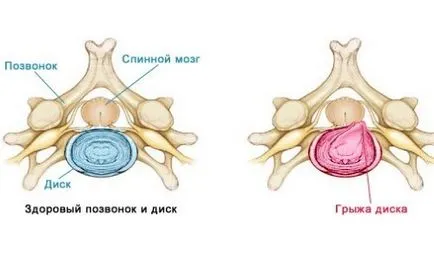 Razele X ale preparatului coloanei vertebrale lumbosacral, care va