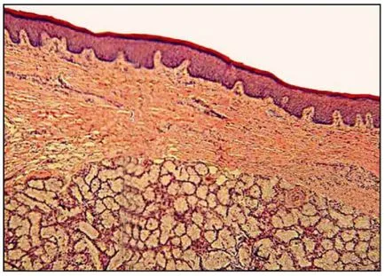 Regenerarea membranei mucoase a gurii - Enciclopedia dentara