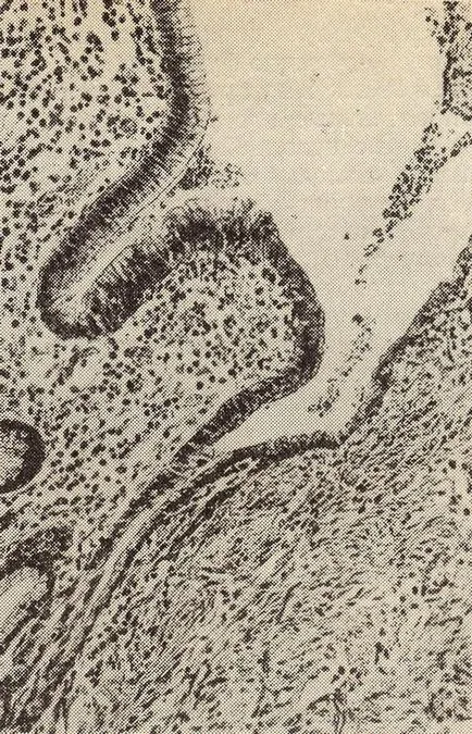 Regenerarea epiteliului - procesele compensatorii-adaptive - anatomie patologică - miere