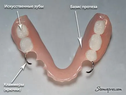 protezele