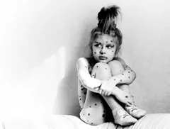 Simptome, tratament și complicațiile varicelei la copii