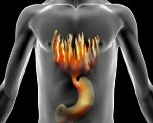 Tünetei és kezelése reflux oesophagitis gyógyszert gyógyszerek, fizikoterápia és a hazai jogorvoslati