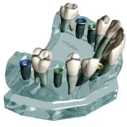 Стоматология Yasenevo (Югозападен), цената на протези и лечение на долни зъби