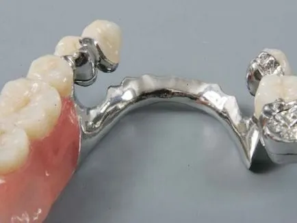 метро Dental барикада