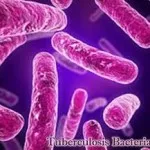 A tuberkulózis és a cukorbetegség - Medical Journal