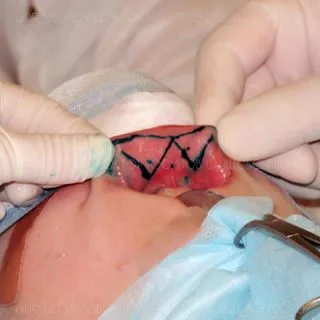 Usclinic - Plasztikai sebészet klinika Yusupova