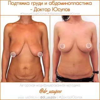 Usclinic - Пластична хирургия Yusupova