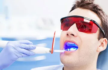 Ултразвуково почистване на зъбите - показания и противопоказания