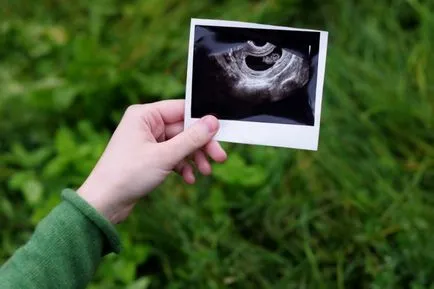 Uzi a 4. héten a terhesség jelent ez a kifejezés, a szabályok