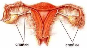 inflamație a uterului uterin cu ultrasunete, tratamentul și diagnosticarea bolilor la Moscova