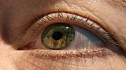 Simptomele bolii oculare retiniene