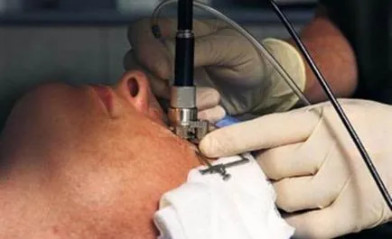 Cum o intervenție chirurgicală la ochi cu miopie recomandări și protivoprokazaniya
