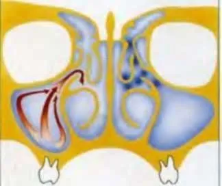 Diagnosticul endoscopica a sinusurilor paranazale