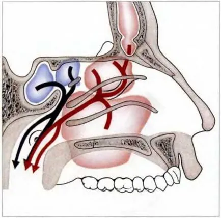 Diagnosticul endoscopica a sinusurilor paranazale