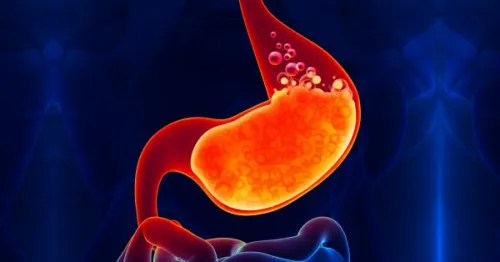 Gastrooesophagealis reflux betegség (GERD) a tünetek és a kezelés, diéta, emberek jogorvoslatok