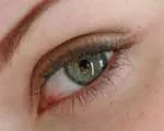 Как да предпазите очите си здрави загуба на зрението е един от най-