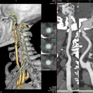 Multislice tomografie computerizată a organelor interne