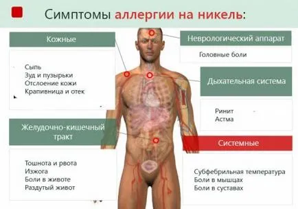 Никел алергия предизвиква обрив на бижута и закопчалки