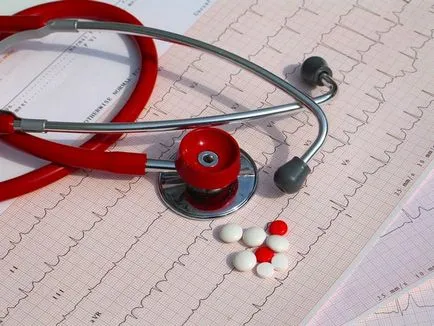 Complicațiile de infarct miocardic putem preveni consecințele