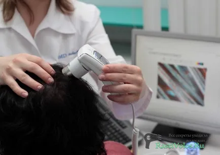 Plazmoterapiya haj válaszok előtt és után az eredményt, az árak, szakértők véleményét, rastivolos